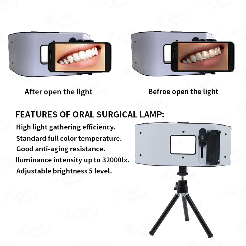 Dental Flash Light Photography - огляд і ціна Photography Lighting With Flash